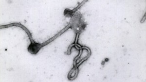 Esta foto sem data disponibilizada pelo Instituto de Medicina Tropical de Antuérpia, em Antuérpia, Bélgica, mostra o vírus Ebola visto através de um microscópio eletrónico
