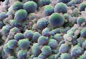 INOVAÇÃO NO TRATAMENTO DO CANCRO DO PÂNCREAS APRESENTADA EM ÉVORA