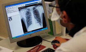 Doenças do foro respiratório foram responsáveis, em 2012, pela morte de 50 portugueses por dia