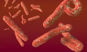 Ebola