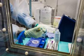 MINISTÉRIO DA SAÚDE BRASILEIRO CONFIRMA PRIMEIRO CASO SUSPEITO DE ÉBOLA