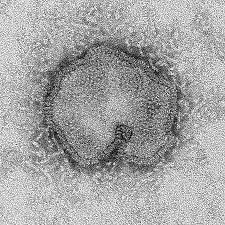Esta imagem de microscópio eletrónica de 15 de abril de 2013, disponibilizada pelos Centros de Controlo e Prevenção de Doenças, mostram o vírus H7N9, que pode assumir uma variedade de formas. The Canadian Press / AP, CDC, CS Goldsmith, T. Rowe