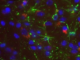 CIENTISTAS TESTAM NOVA TÉCNICA PARA TRATAR ALZHEIMER ATRAVÉS DE ULTRASSONS