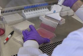 DESCOBERTO NOVO FÁRMACO CONTRA A LEUCEMIA LINFOBLÁSTICA AGUDA INFANTIL