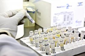 CONFERÊNCIA DEBATE VACINA PARA SIDA QUE PODE CHEGAR EM MENOS DE UMA DÉCADA – INVESTIGADOR