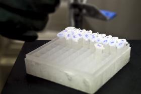 BRASIL CONSTRÓI LABORATÓRIO DE COMBATE A TUBERCULOSE EM SÃO TOMÉ E PRÍNCIPE