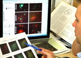 PERITOS DEFENDEM UMA ATENÇÃO ESPECIAL À NUTRIÇÃO DOS DOENTES COM ALZHEIMER