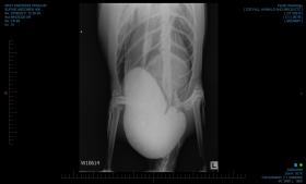 BE QUESTIONA GOVERNO SOBRE FALTA DE RADIOLOGISTAS EM HOSPITAIS DO NORTE
