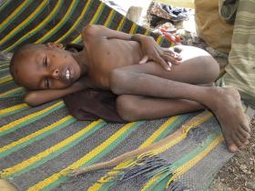 UM MILHÃO DE CRIANÇAS COM DESNUTRIÇÃO GRAVE NA ÁFRICA ORIENTAL E AUSTRAL, ALERTA UNICEF