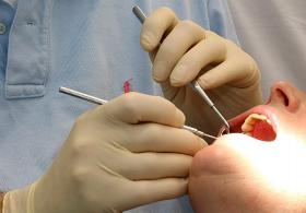 CÁRIES DENTÁRIAS SÃO A DOENÇA NÃO CONTAGIOSA MAIS COMUM NO MUNDO – OMS