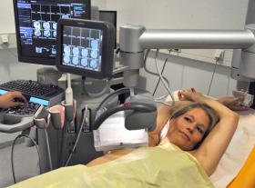 QUASE METADE DOS DOENTES COM CANCRO DA MAMA A FAZER QUIMIO PODIA EVITÁ-LA – ESTUDO