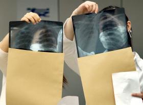 DOENÇAS RESPIRATÓRIAS MATAM 47 PORTUGUESES POR DIA – OBSERVATÓRIO