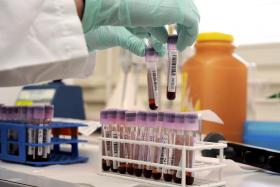 GOVERNO BRITÂNICO ORDENA INVESTIGAÇÃO A MÉDICO SUSPEITO DE FORNECER DOPING A ATLETAS