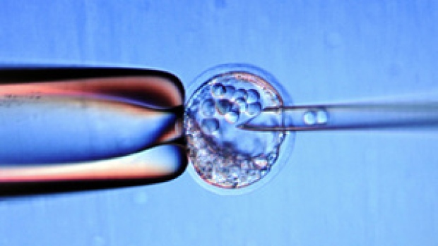 O ministro da Saúde do Ontário, Eric Hoskins, criou um grupo de trabalho para expandir o acesso a transplantes de células estaminais para pacientes com leucemia. (Anne-Christine Poujoulat / AFP / Getty)