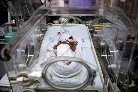 NASCEM 17 BEBÉS PREMATUROS POR DIA EM PORTUGAL, OITO POR CENTO DE TODOS OS NASCIMENTOS