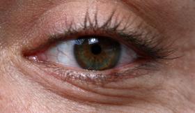 EXAME AOS OLHOS PODERÁ DIAGNOSTICAR PRECOCEMENTE DOENÇA DE PARKINSON – ESTUDO