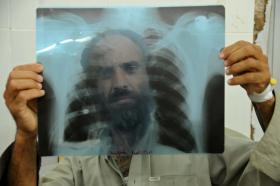 MAIS DE 10 MILHÕES DE NOVOS CASOS DE TUBERCULOSE SURGIRAM EM 2015 – OMS