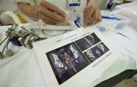 TÉCNICOS DE DIAGNÓSTICO E TERAPÊUTICA MARCAM GREVE POR TEMPO INDETERMINADO