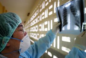 TEMPO DE SOBREVIVÊNCIA NO CANCRO DO PULMÃO DUPLICA COM NOVOS TRATAMENTOS