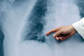 GOVERNO REPÕE 25% DE HORAS EXTRA A TODOS OS MÉDICOS A PARTIR DE ABRIL