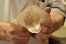 PORTUGAL COM 80 CASOS DE ROTURAS DE IMPLANTES MAMÁRIOS PIP EM 67 MULHERES