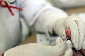DOENTES COM VIH FALHAM CONSULTAS DE ESPECIALIDADE POR MOTIVOS FINANCEIROS – ESTUDO