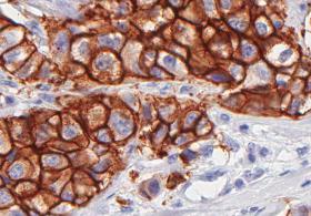 CIENTISTAS CRIAM TESTE SANGUÍNEO PARA DETEÇÃO PRECOCE DE CANCROS A PARTIR DE ADN