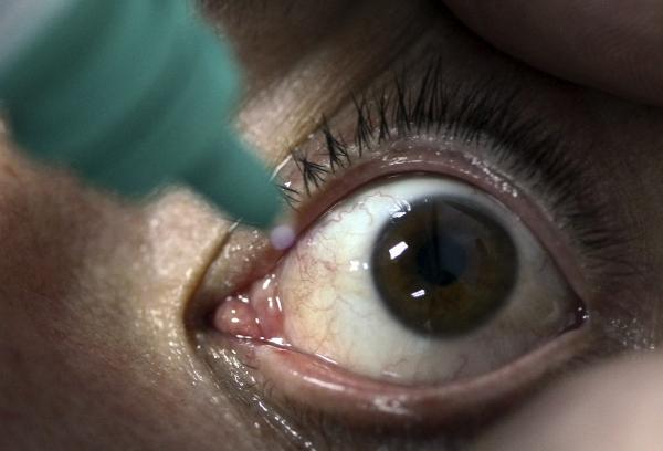 INVESTIGADORES PORTUGUESES CRIAM NOVA FERRAMENTA PARA DIAGNOSTICAR CATARATAS