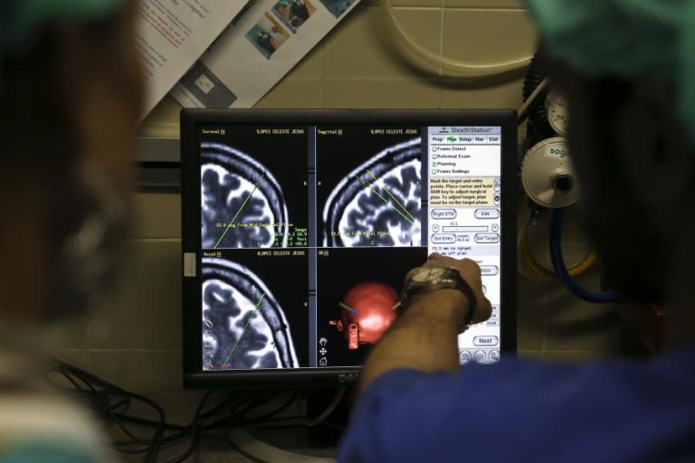 INVESTIGADORES DESCOBREM MOLÉCULAS QUE PODEM AJUDAR A RETARDAR DOENÇA DE PARKINSON
