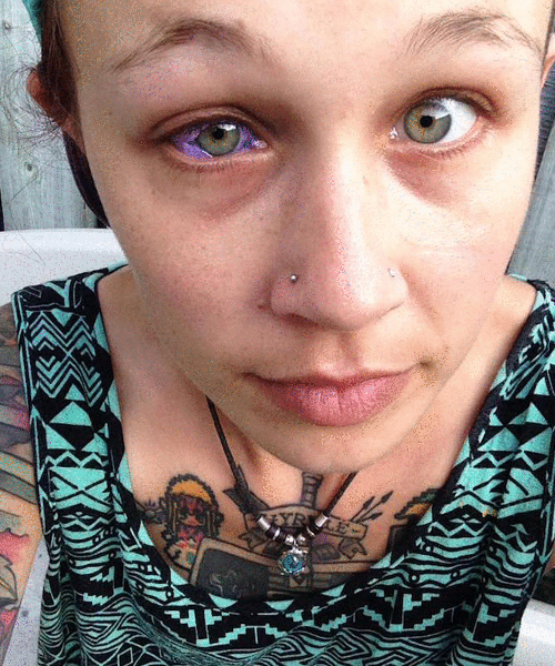 ONTÁRIO VAI PROIBIR TATUAGENS NOS OLHOS