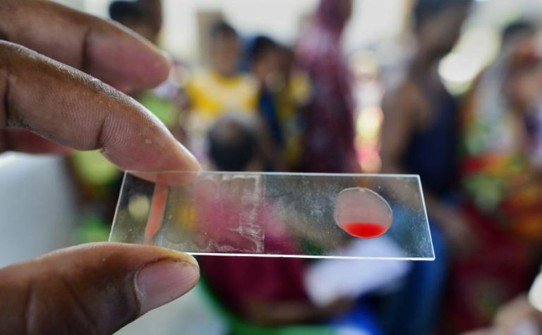 NOVO TESTE SANGUÍNEO EXPERIMENTAL DETETA OITO TIPOS DE CANCRO