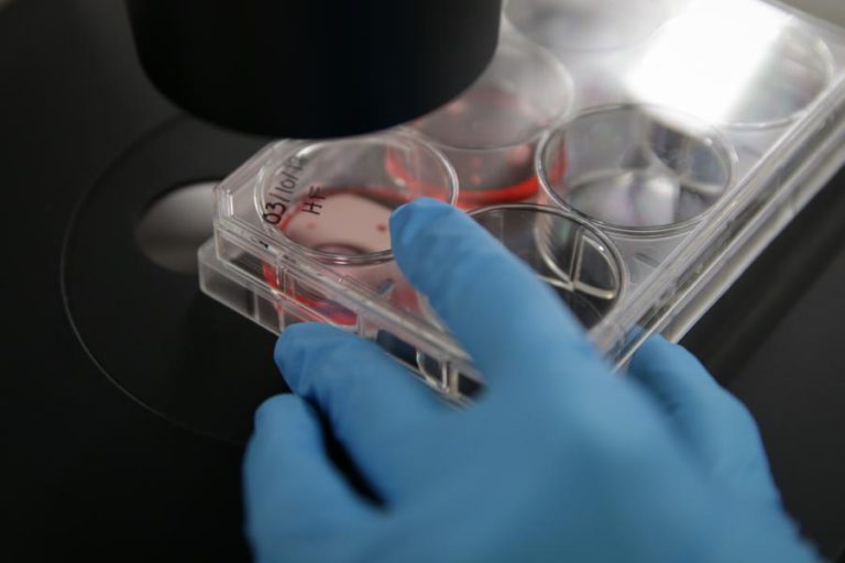 CONTROLO DE PROTEÍNA NOS CROMOSSOMAS PODE PREVENIR MECANISMO GENÉTICO LIGADO AO CANCRO