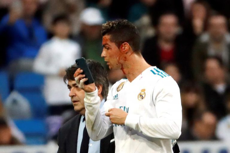 CRISTIANO RONALDO SUTURADO COM “DOIS OU TRÊS PONTOS”