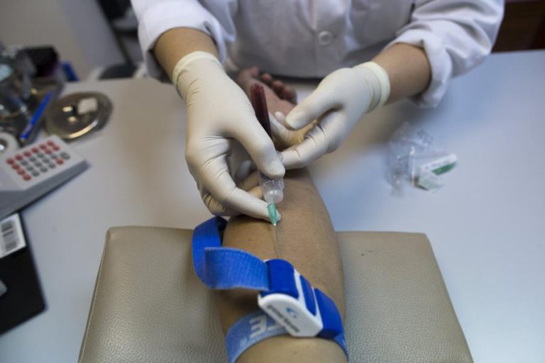 TESTES DE VIH E HEPATITES NAS FARMÁCIAS SEM NECESSIDADE DE PRESCRIÇÃO MÉDICA