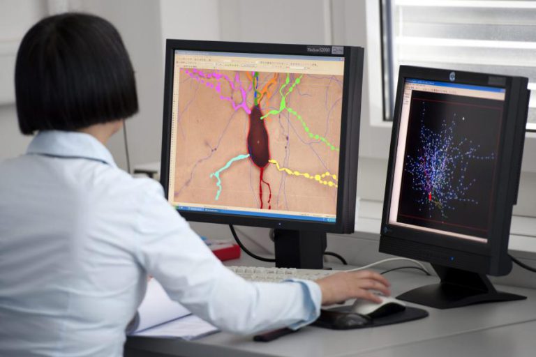INVESTIGADORES DESCOBREM COMO CONTROLAR A DISSEMINAÇÃO DE TUMOR MALIGNO NO CÉREBRO