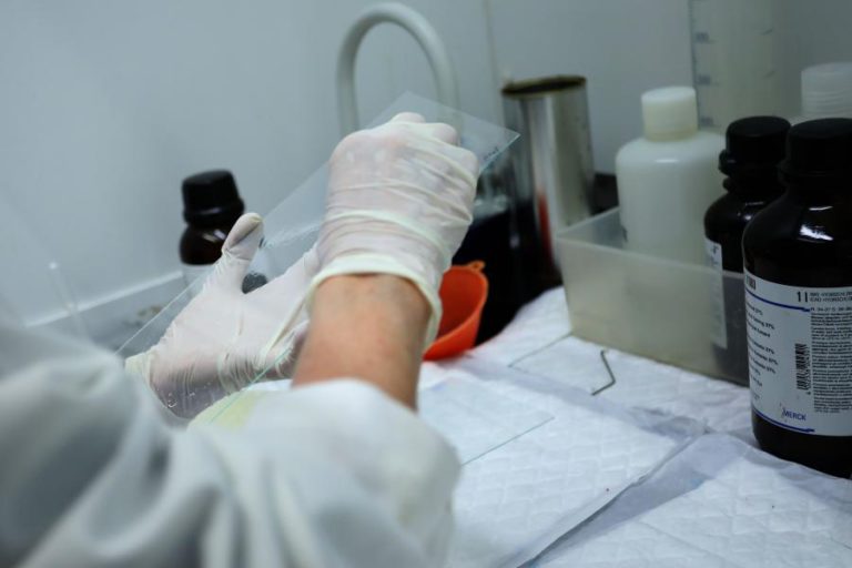 INVESTIGADORES DO PORTO ESTUDAM PROTEÍNA PARA TRATAR DOENTES DE ALZHEIMER