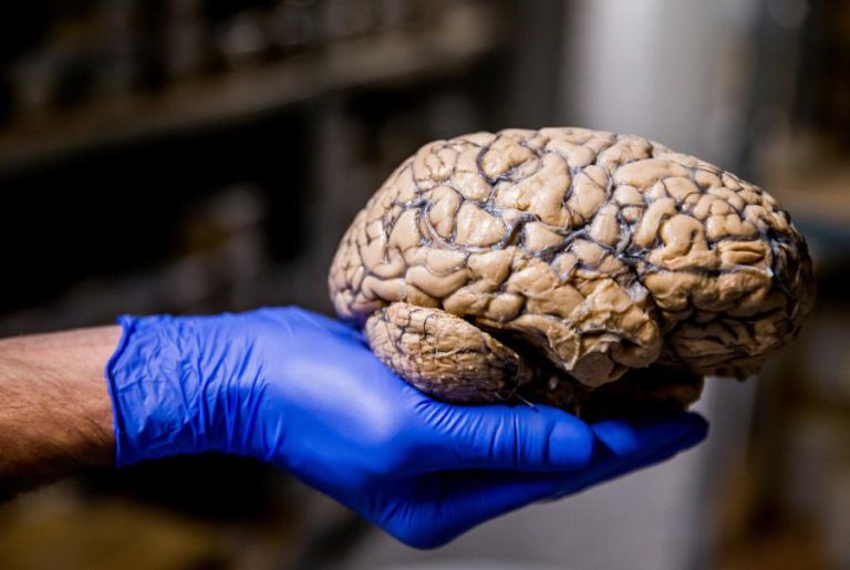 DESEQUILÍBRIO DO PH NO CÉREBRO PODE SER CAUSA DE ALZHEIMER – ESTUDO