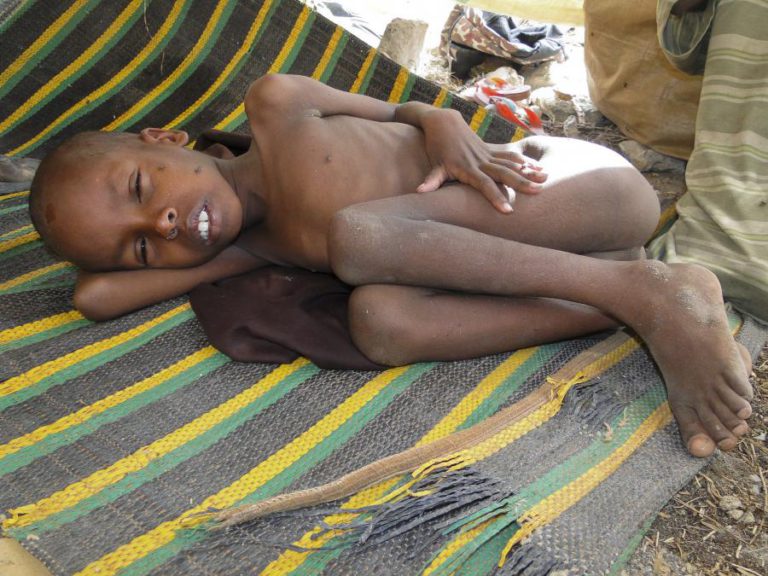 NÚMEROS DA MORTALIDADE INFANTIL MELHORAM MAS CONTINUAM INACEITÁVEIS – ONU
