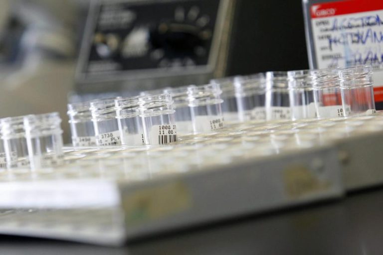 CIENTISTAS CHINESES TESTAM VACINA CONTRA A SIDA EM SERES HUMANOS