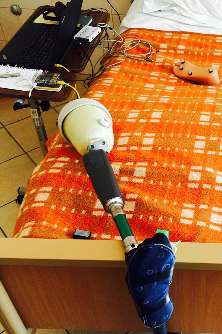 INVESTIGADORES CRIAM PRÓTESE QUE DEVOLVE SENSAÇÃO E AUTONOMIA A AMPUTADOS