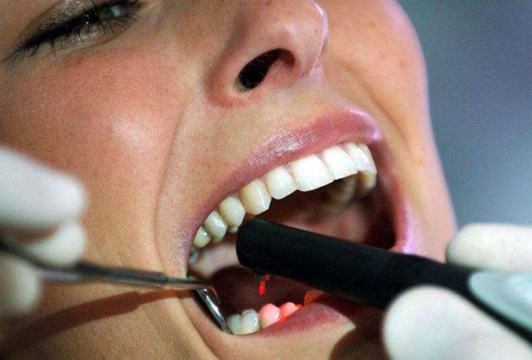 MAIS DE 30% DOS PORTUGUESES NÃO VÃO AO DENTISTA OU SÓ VÃO EM CASO DE URGÊNCIA – BARÓMETRO