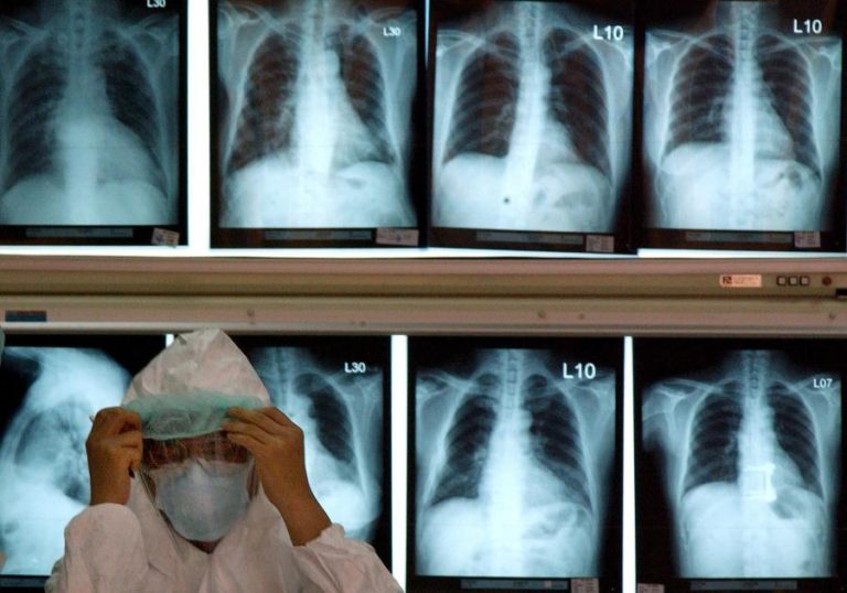 PNEUMONIA COMUM MATA 16 POR DIA EM PORTUGAL E 11 MIL POR MÊS NA EUROPA