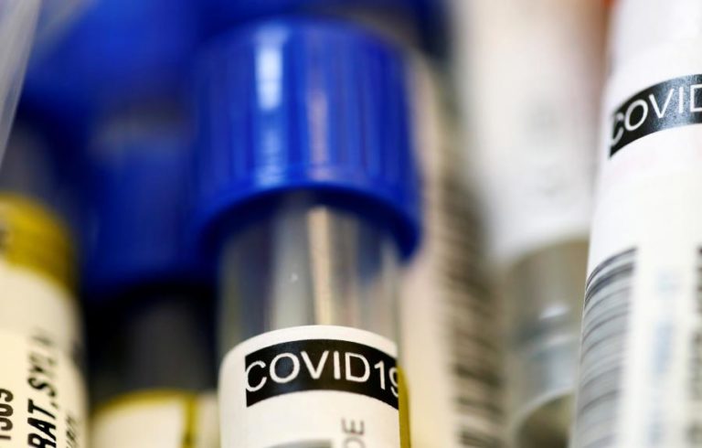 COVID-19: RASTREIO A PROFESSORES E FUNCIONÁRIOS DETETOU CASO POSITIVO EM VILA REAL