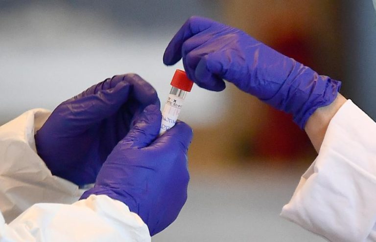 COVID-19: QUASE METADE DOS MÉDICOS QUE TIVERAM CONTACTO COM CASOS NUNCA FORAM TESTADOS