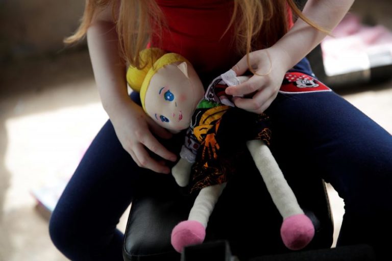 COVID-19: ASSOCIAÇÃO DIZ QUE MAIS ALBINOS PEDEM AJUDA ALIMENTAR EM MOÇAMBIQUE