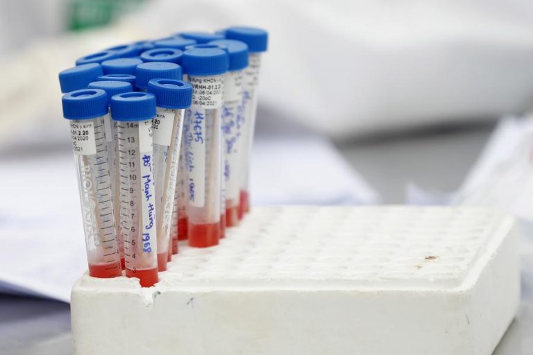 COVID-19: GUINÉ-BISSAU REGISTA MAIS 83 NOVOS CASOS E AUMENTA PARA 1.339