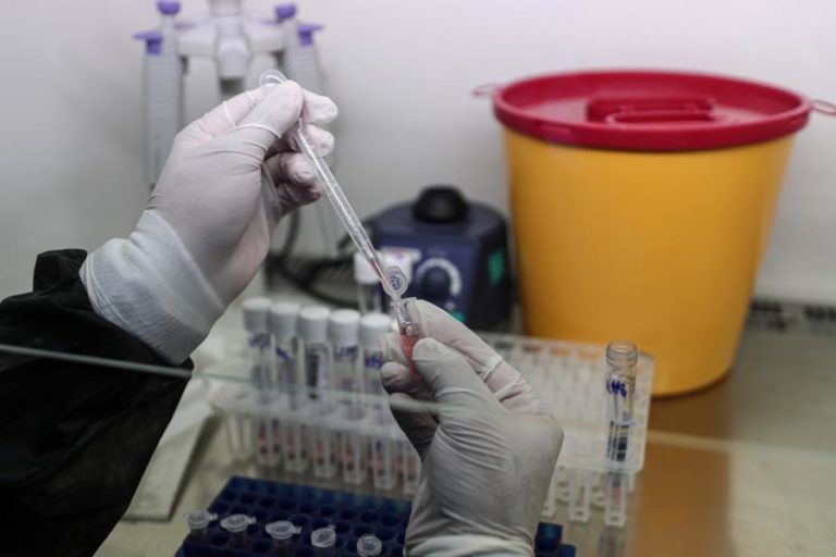 COVID-19: CABO VERDE REGISTA MAIS 22 CASOS E AUMENTA TOTAL PARA 457