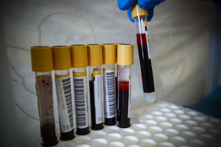 COVID-19: ITÁLIA REGISTA 30 ÓBITOS E 259 NOVOS CASOS NAS ÚLTIMAS 24 HORAS