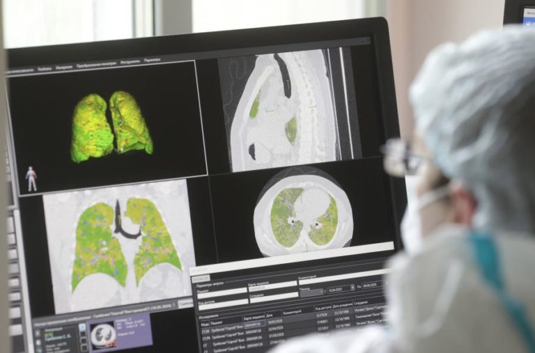 COVID-19: ACIDENTES VASCULARES CEREBRAIS COMUNS ENTRE DOENTES COM COMPLICAÇÕES NEUROLÓGICAS – ESTUDO