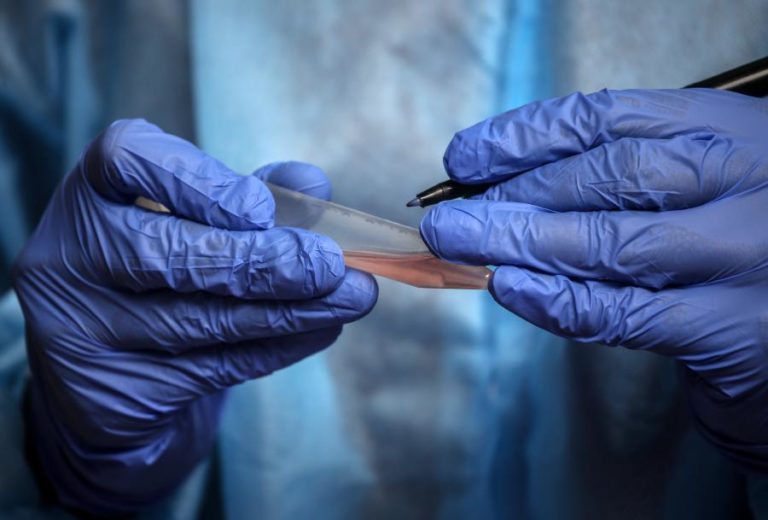COVID-19: VÍRUS JÁ MATOU QUASE 480 MIL PESSOAS E INFETOU MAIS DE 9,3 MILHÕES NO MUNDO
